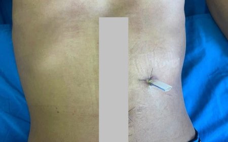 Violência na 50ª EAPIC: Jovem de 19 anos é agredido por seguranças e vai parar na UTI