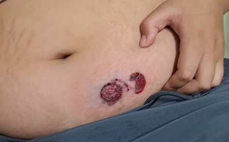 Adolescente autista e sua mãe ficam feridos após intervenção da Polícia Militar em Muzambinho